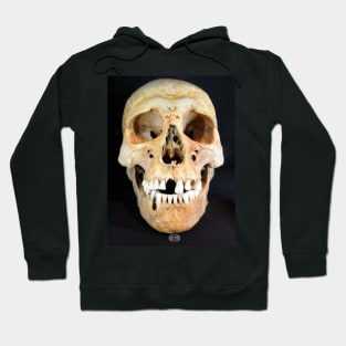 Skull Hoodie